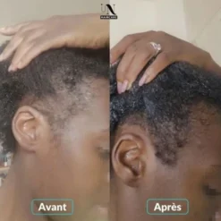 In Haircare Gummies cure pousse de cheveux