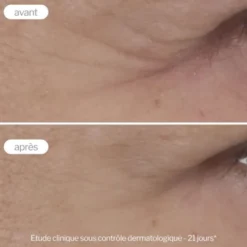 Novexpert Contour des yeux anti-âge Expert - 15 ml