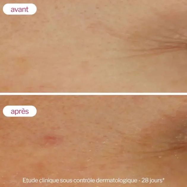 Novexpert Sérum booster à l'acide hyaluronique - 30 ml