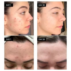 Odacité Sérum anti-imperfections Bl + C - 5ml