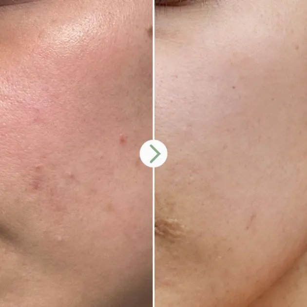 Pai Skincare Booster Super Apaisant Tri-Mushroom - 10 ml